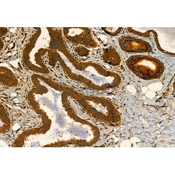 MMP9 Antibody - AF5228 at 1/100 staining Human normal tissues adjacent to mammary cancer by IHC-P.