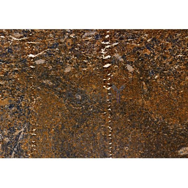 MMP9 Antibody - AF5228 at 1/100 staining Rat spleen tissue by IHC-P.