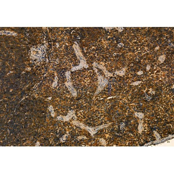 MMP9 Antibody - AF5228 at 1/100 staining Mouse spleen tissue by IHC-P.