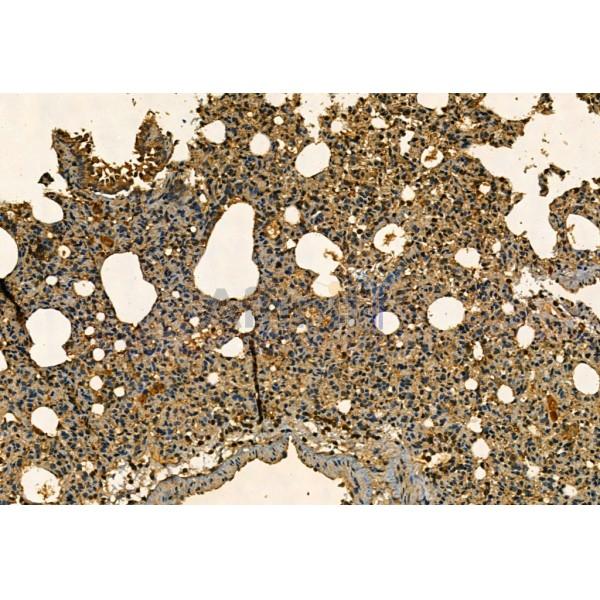 MMP9 Antibody - AF5228 at 1/100 staining Rat lung tissue by IHC-P.