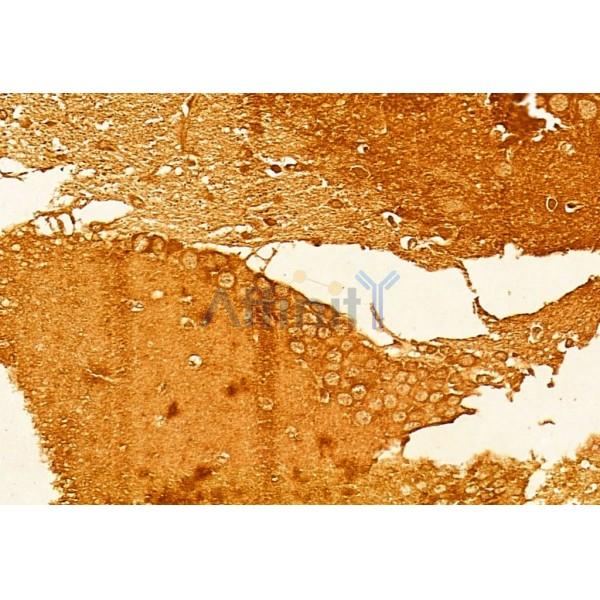 PSD95 Antibody - AF5283 at 1/100 staining Rat brain tissue by IHC-P.