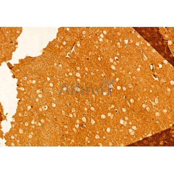 Cleaved-Notch 1 (Val1744) Antibody - AF5307 at 1/100 staining Mouse brain tissue by IHC-P.