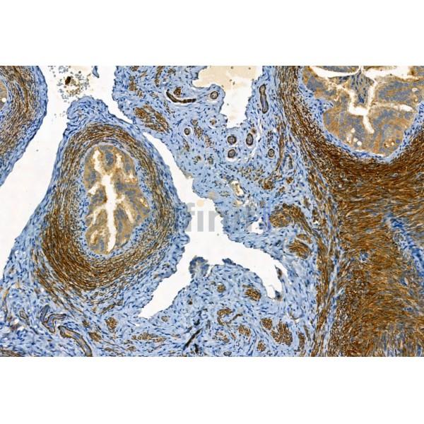 MMP2 Antibody - AF5330 at 1/100 staining Rat ovary tissue by IHC-P.