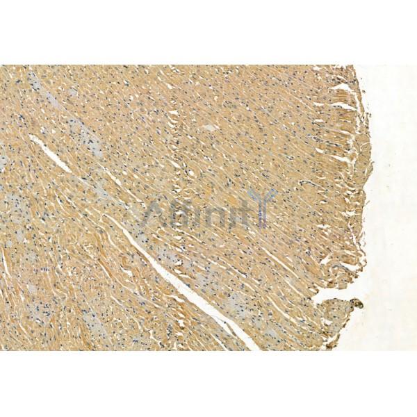SQSTM1/p62 Antibody - AF5384 at 1/100 staining Rat heart tissue by IHC-P.
