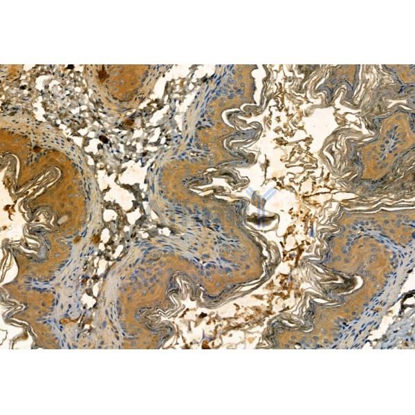 SQSTM1/p62 Antibody - AF5384 at 1/100 staining Mouse stomach tissue by IHC-P.