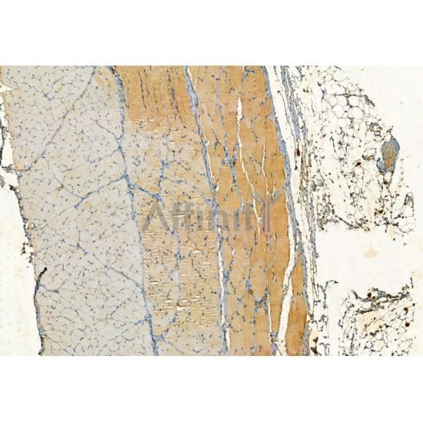 SQSTM1/p62 Antibody - AF5384 at 1/100 staining Rat skin tissue by IHC-P.