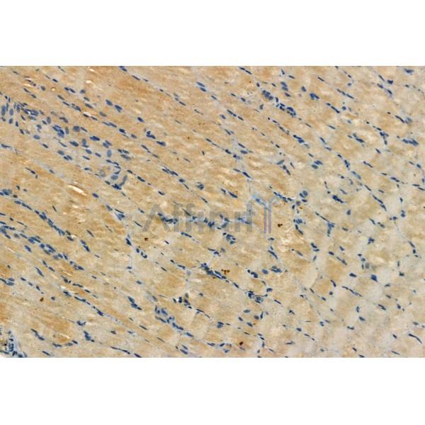 SQSTM1/p62 Antibody - AF5384 at 1/100 staining Rat muscle tissue by IHC-P.
