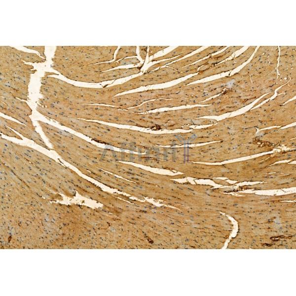 SQSTM1/p62 Antibody - AF5384 at 1/100 staining Mouse heart tissue by IHC-P.
