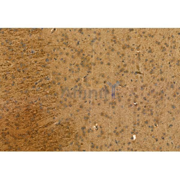 SQSTM1/p62 Antibody - AF5384 at 1/100 staining Mouse colon tissue by IHC-P.