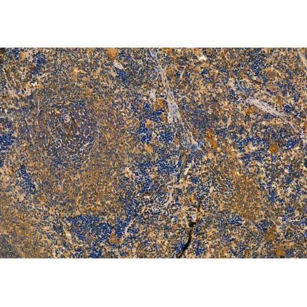 SQSTM1/p62 Antibody - AF5384 at 1/100 staining Rat spleen tissue by IHC-P.