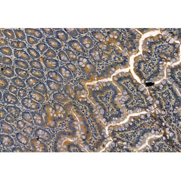 SQSTM1/p62 Antibody - AF5384 at 1/100 staining Rat colon tissue by IHC-P.
