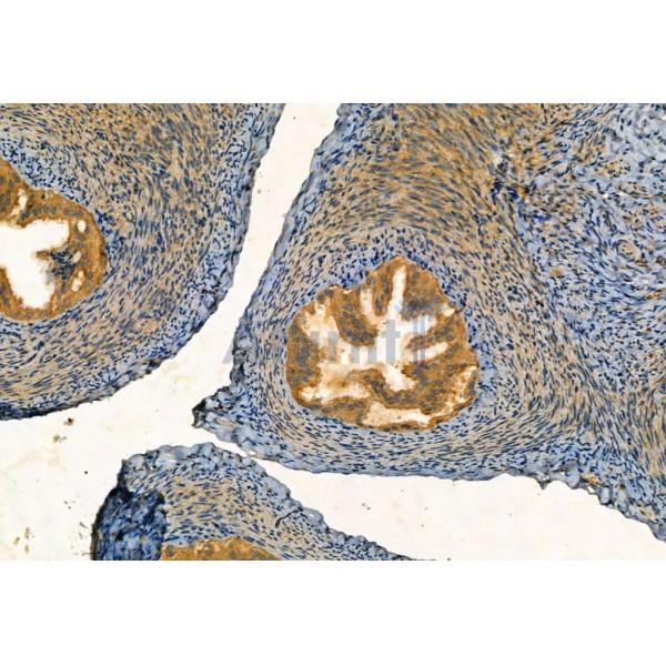 SQSTM1/p62 Antibody - AF5384 at 1/100 staining Rat ovary tissue by IHC-P.