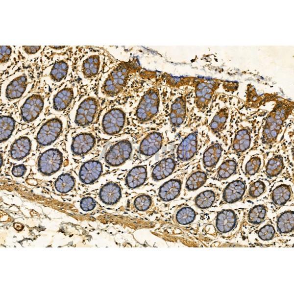 SQSTM1/p62 Antibody - AF5384 at 1/100 staining Human normal tissues adjacent to colorectal cancer by IHC-P.
