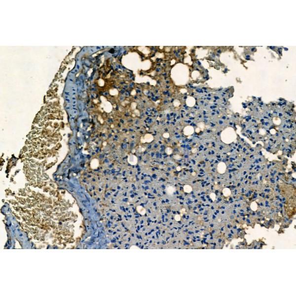 Caspase 1 Antibody - AF5418 at 1/100 staining Mouse lung tissue by IHC-P.