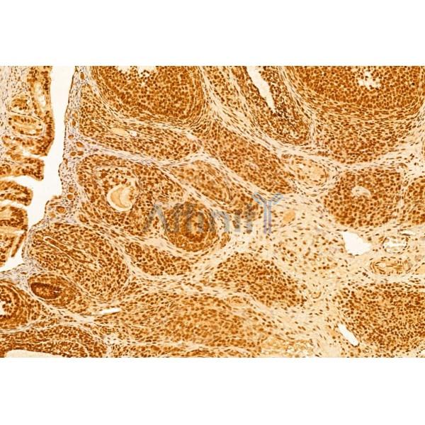 mTOR Antibody - AF6308 at 1/100 staining Rat ovary tissue by IHC-P.