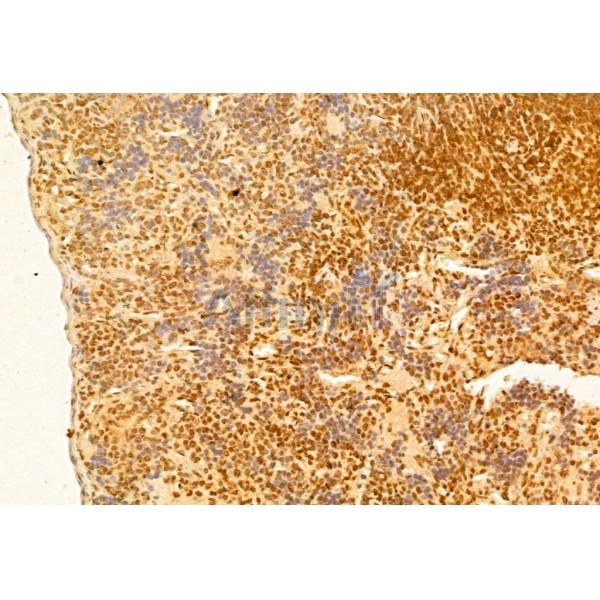 mTOR Antibody - AF6308 at 1/100 staining Rat spleen tissue by IHC-P.