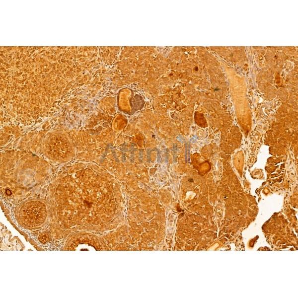 mTOR Antibody - AF6308 at 1/100 staining Mouse ovary tissue by IHC-P.