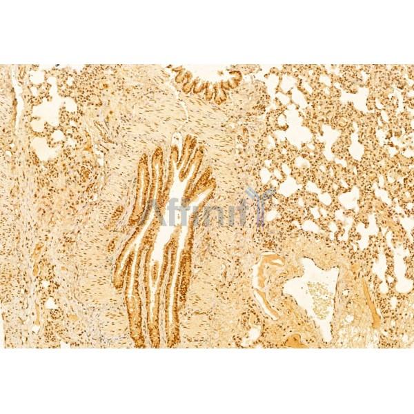 mTOR Antibody - AF6308 at 1/100 staining Rat lung tissue by IHC-P.