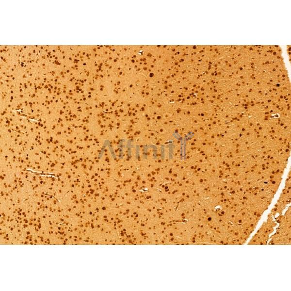 mTOR Antibody - AF6308 at 1/100 staining Rat brain tissue by IHC-P.