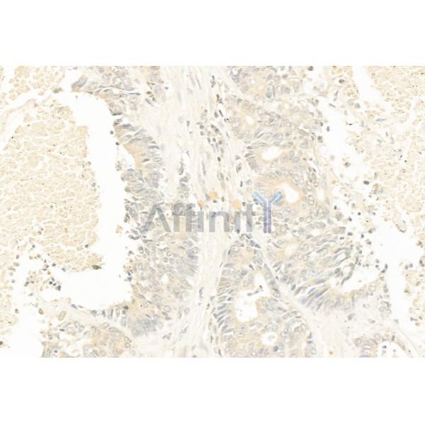 PTEN Antibody - AF6351 at 1/100 staining Human normal tissues adjacent to colorectal cancer by IHC-P.