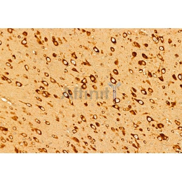 Collagen I Antibody - AF7001 at 1/100 staining Rat brain tissue by IHC-P.