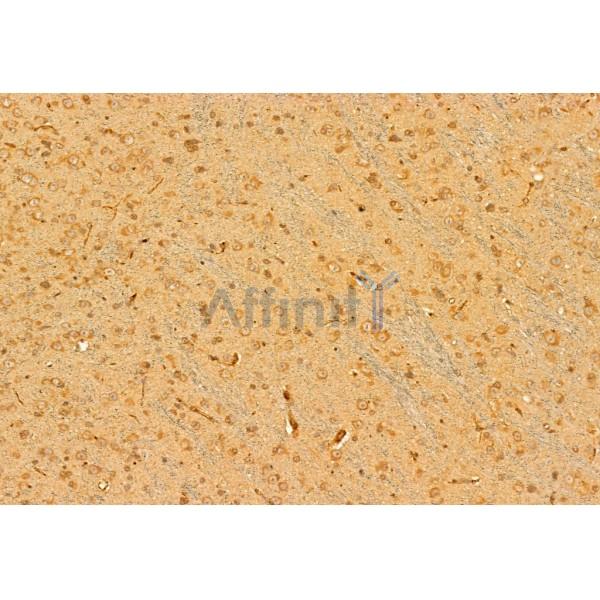 Collagen I Antibody - AF7001 at 1/100 staining Mouse brain tissue by IHC-P.