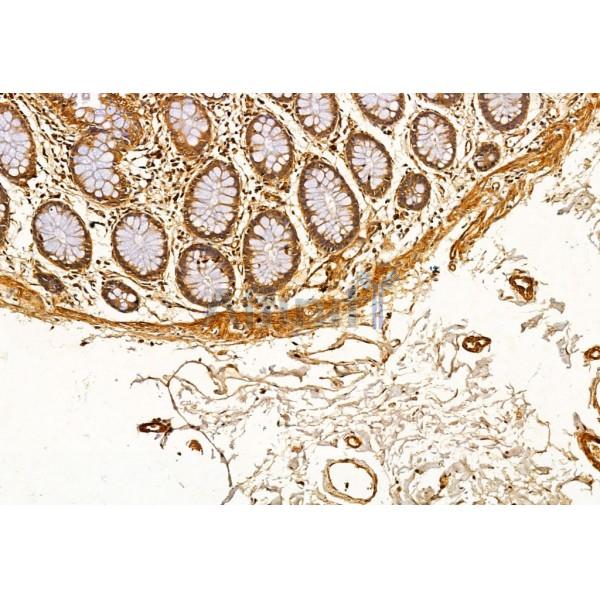 Collagen I Antibody - AF7001 at 1/100 staining Human normal tissues adjacent to colorectal cancer by IHC-P.