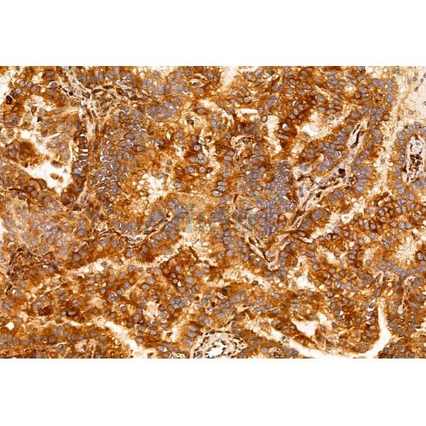 TNF alpha Antibody - AF7014 at 1/100 staining Human normal tissues adjacent to lung cancer by IHC-P.