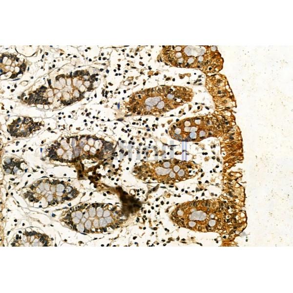 Phospho-IRE1 (Ser724) Antibody - AF7150 at 1/100 staining Human normal tissues adjacent to colorectal cancer by IHC-P.