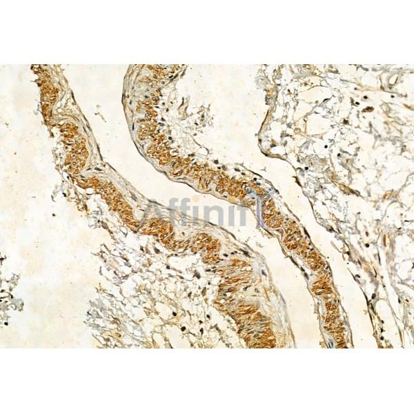 Phospho-IRE1 (Ser724) Antibody - AF7150 at 1/100 staining Human normal tissues adjacent to pancreatic cancer by IHC-P.