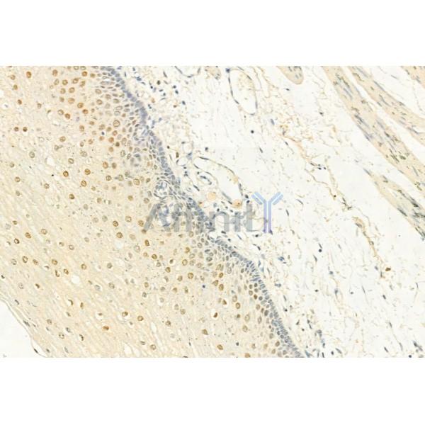 Phospho-CDK4 (Thr172) Antibody - AF8007 at 1/100 staining Human normal tissues adjacent to esophageal cancer by IHC-P.