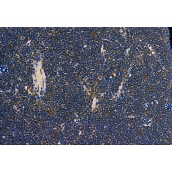 Phospho-Smad3 (Ser423+Ser425) Antibody - AF8315 at 1/100 staining Rat thymus tissue by IHC-P.