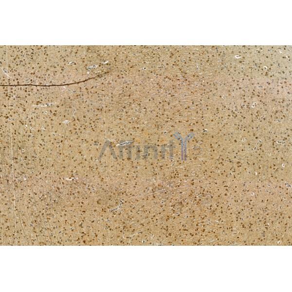 Phospho-Smad3 (Ser423+Ser425) Antibody - AF8315 at 1/100 staining Rat brain tissue by IHC-P.