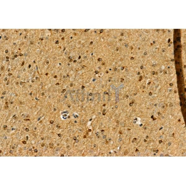 Phospho-Smad3 (Ser423+Ser425) Antibody - AF8315 at 1/100 staining Mouse brain tissue by IHC-P.