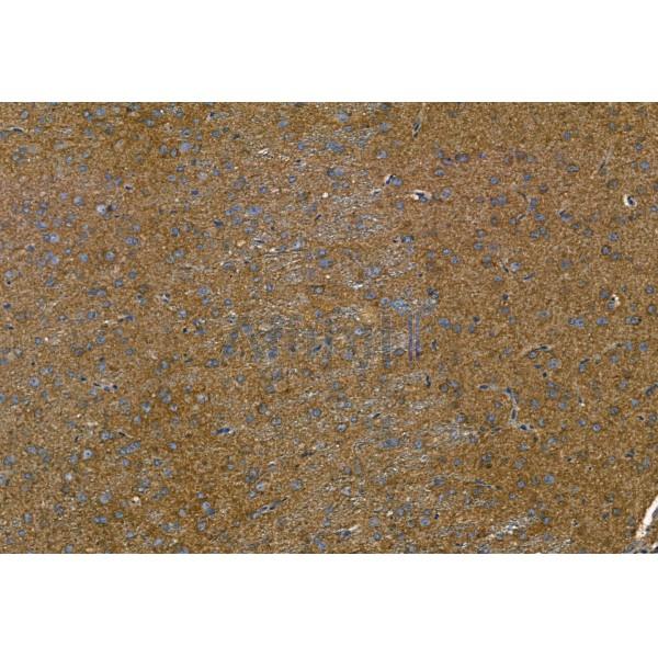 Phospho-TGFBR1 (Thr204) Antibody - AF8456 at 1/100 staining Rat brain tissue by IHC-P.