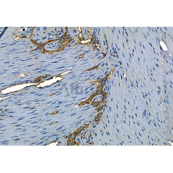 Phospho-TGFBR1 (Thr204) Antibody - AF8456 at 1/100 staining Mouse stomach tissue by IHC-P.