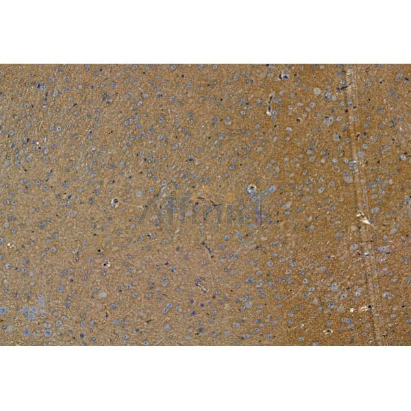 Phospho-TGFBR1 (Thr204) Antibody - AF8456 at 1/100 staining Mouse brain tissue by IHC-P.