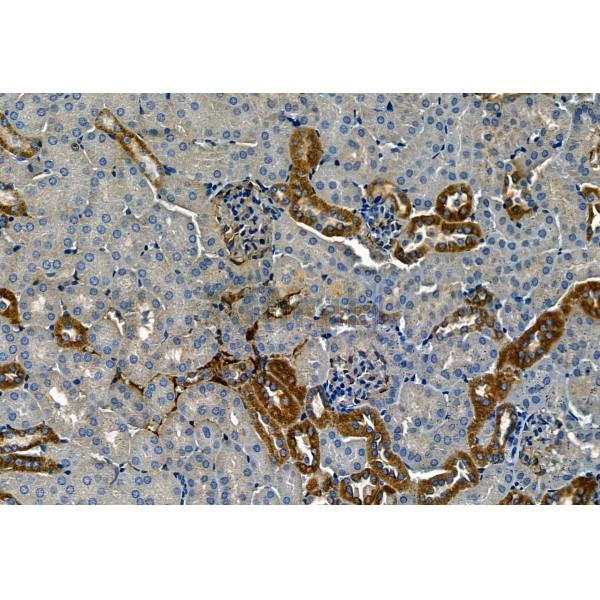 Phospho-TGFBR1 (Thr204) Antibody - AF8456 at 1/100 staining Mouse kidney tissue by IHC-P.