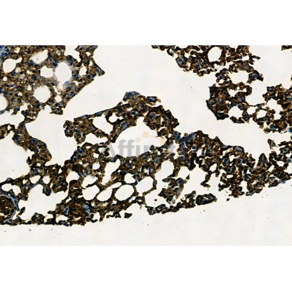 APOBEC3A Antibody - AF9009 at 1/100 staining Mouse lung tissue by IHC-P.