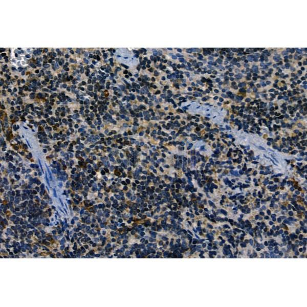 APOBEC3A Antibody - AF9009 at 1/100 staining Mouse spleen tissue by IHC-P.