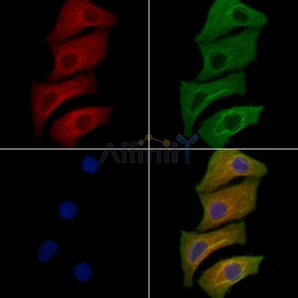 Rab 34 Antibody - AF9174 staining Hela cells by IF/ICC.