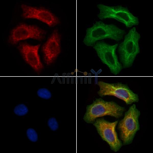 TMC8 Antibody - AF9215 staining Hela cells by IF/ICC.