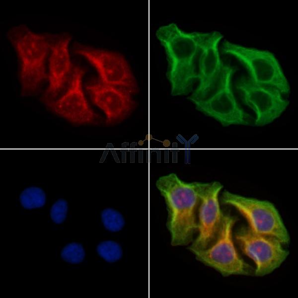 AKAP4 Antibody - DF10048 staining Hela cells by IF/ICC.