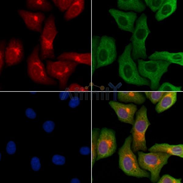 LARP2 Antibody - DF10053 staining Hela cells by IF/ICC.