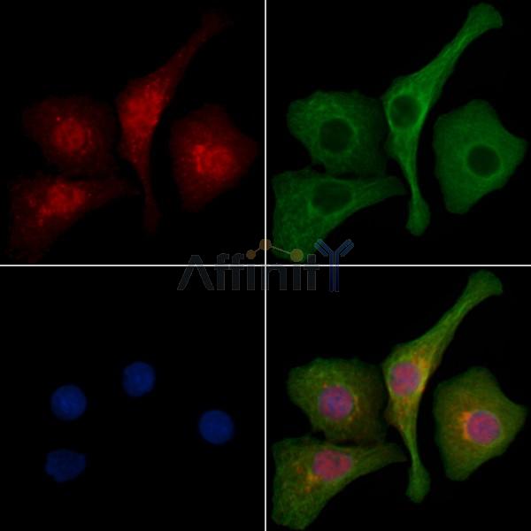 LZTR1 Antibody - DF10067 staining Hela cells by IF/ICC.