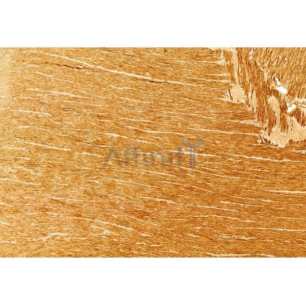 NEB2 Antibody - DF10075 at 1/100 staining Rat stomach tissue by IHC-P.