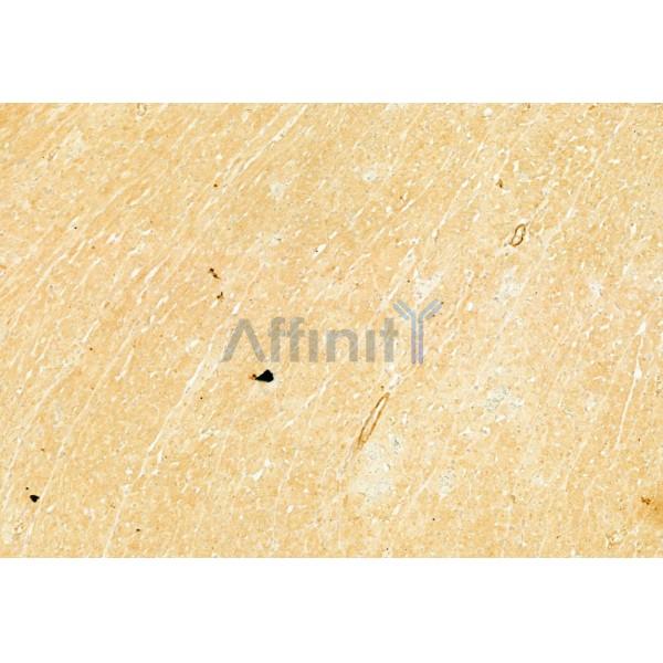 NEB2 Antibody - DF10075 at 1/100 staining Rat heart tissue by IHC-P.