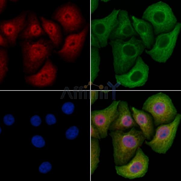 DYRK2 Antibody - DF10136 staining Hela cells by IF/ICC.