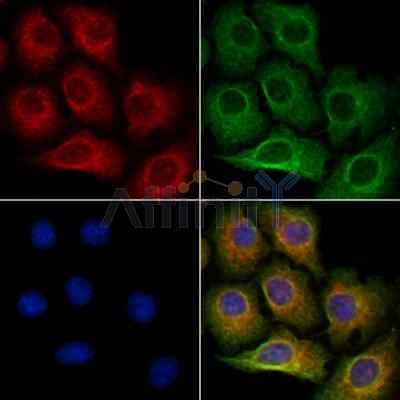 FDCSP Antibody - DF10187 staining Hela cells by IF/ICC.