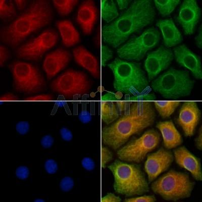 GPR179 Antibody - DF10219 staining Hela cells by IF/ICC.